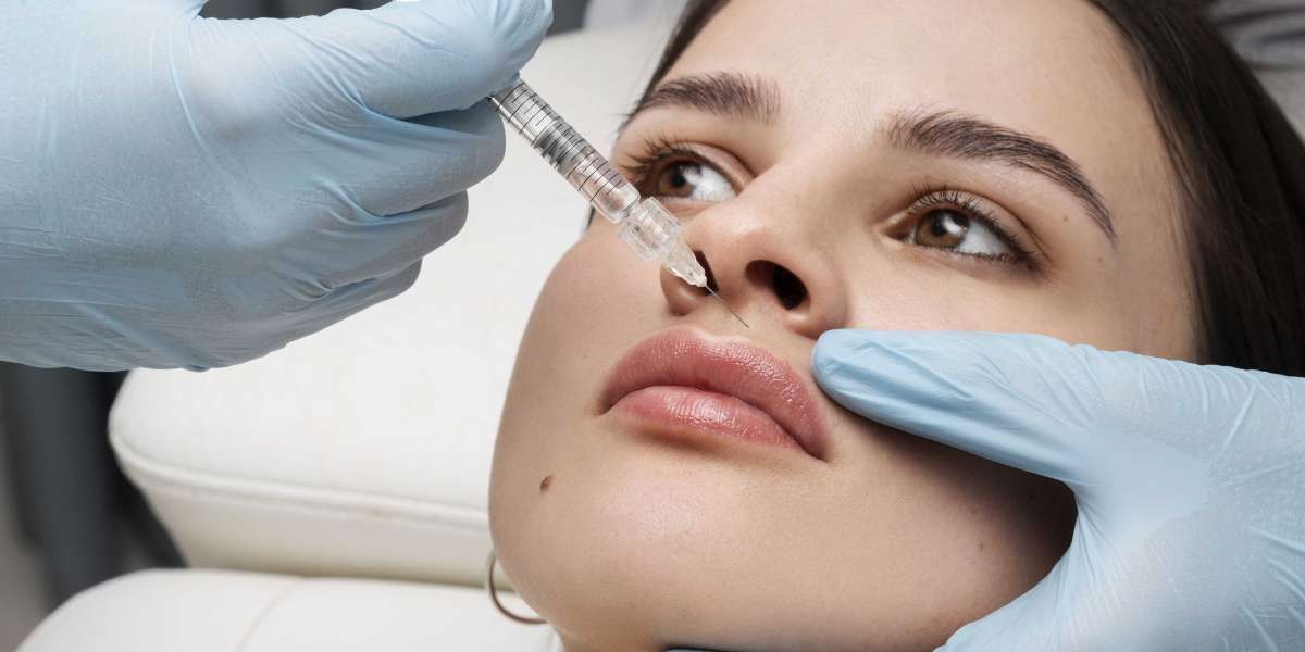 What areas can be treated with dermal fillers at IVital Health?