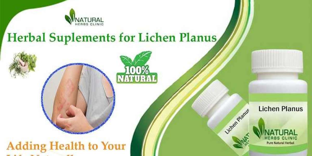 Lichen Planus Treatment Breakthroughs: Home Remedies You Need to Know