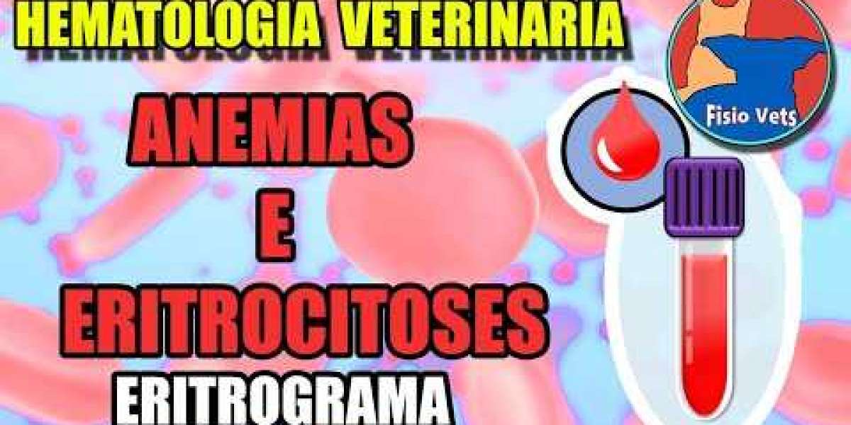 Ecocardiograma y electrocardiograma