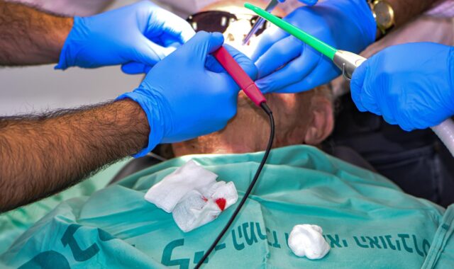 suction, electrosurgery, dental, anaesthesia, hospital, surgery, patient, dental office, scalpel, teamwork, scissors, treatment, biopsy, tube, outpatient, emergency, diagnosis, dentistry, syringe, team, disease, dental clinic, op