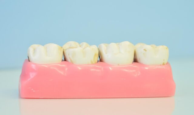 teeth macro model, odontological office, teeth, teeth, teeth, teeth, teeth, teeth